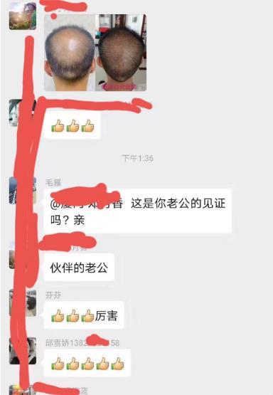 慕颜之家防脱发洗发水