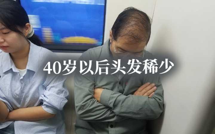 40岁以后头发稀少正常吗